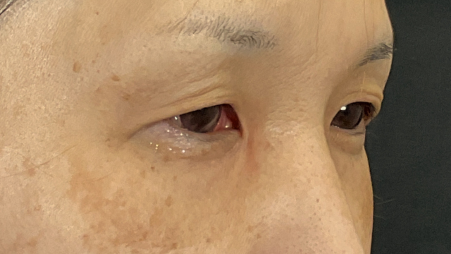 Postoperative Condition Part 1