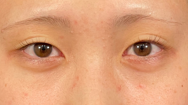 Postoperative Condition Part 1