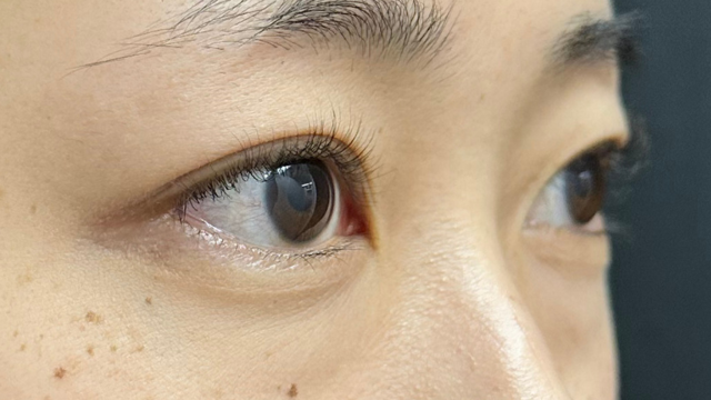 Postoperative Condition Part 1