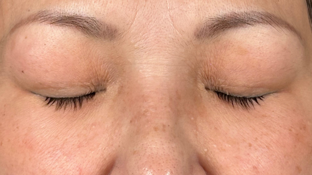 Postoperative Condition Part 1