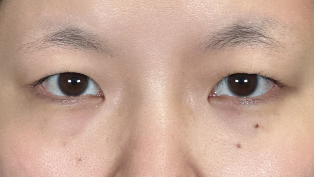 Postoperative Condition Part 1