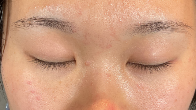 Postoperative Condition Part 1