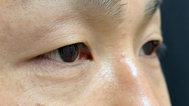 Postoperative Condition Part 1