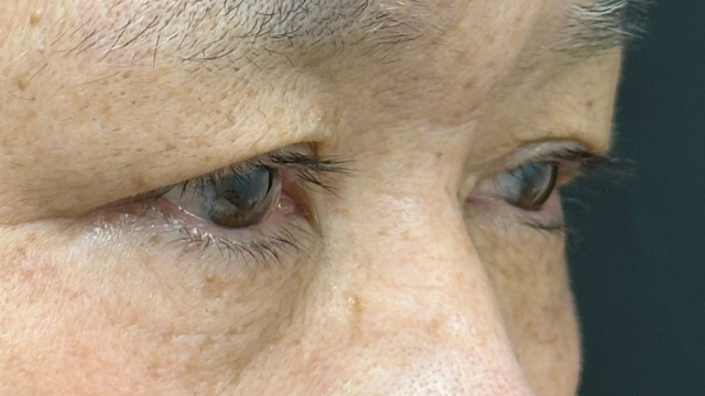 Postoperative Condition Part 1