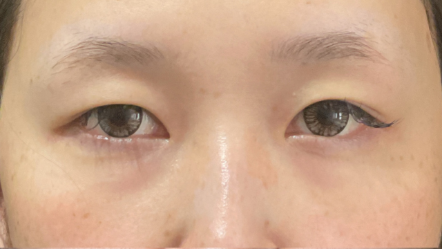 Postoperative Condition Part 1