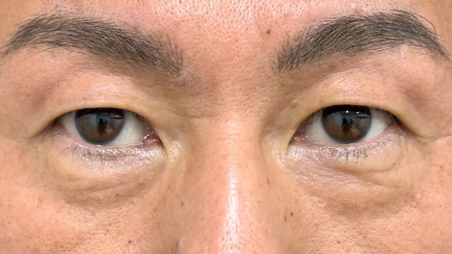 Postoperative Condition Part 1