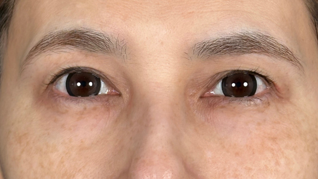 Postoperative Condition Part 1