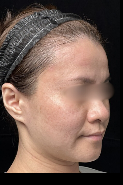 手術前の状態 その1