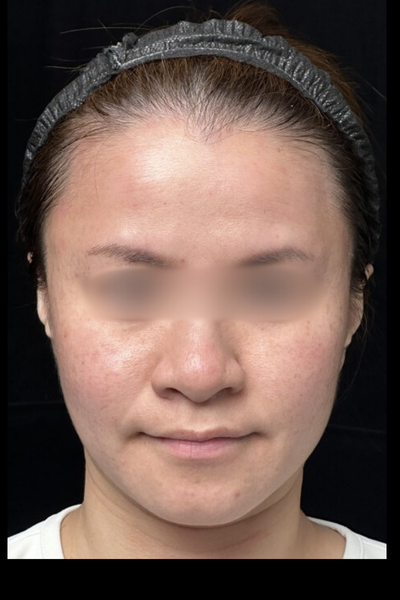 手術前の状態 その1