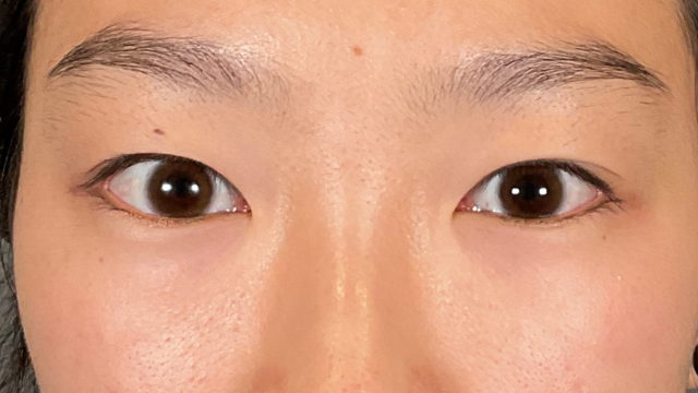 Postoperative Condition Part 1