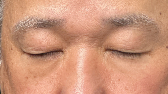 Postoperative Condition Part 1