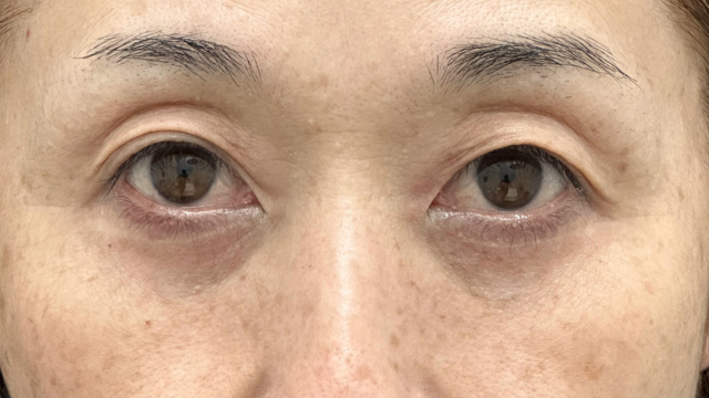 Postoperative Condition Part 1