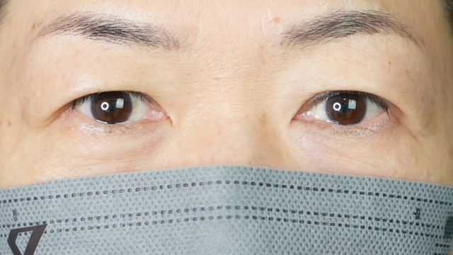 Postoperative Condition Part 1