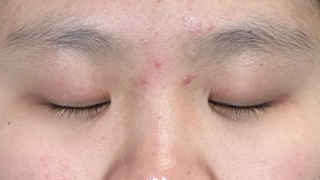 Postoperative Condition Part 1