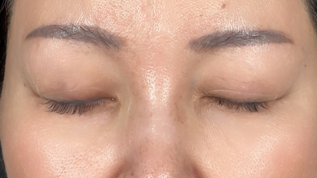 Postoperative Condition Part 1