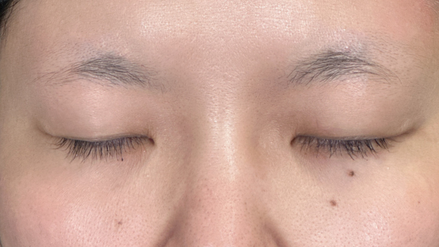 Postoperative Condition Part 1