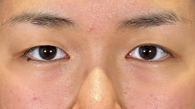 Postoperative Condition Part 1