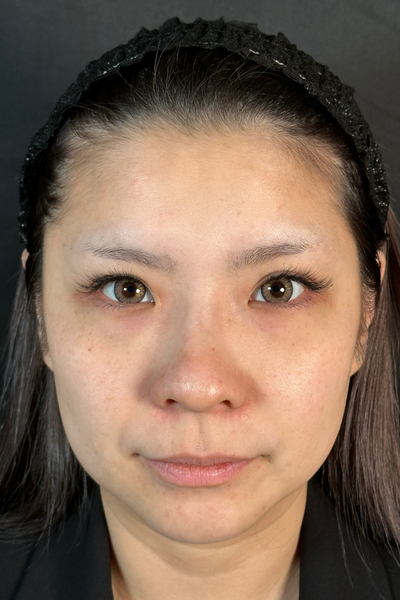 手術前の状態 その1