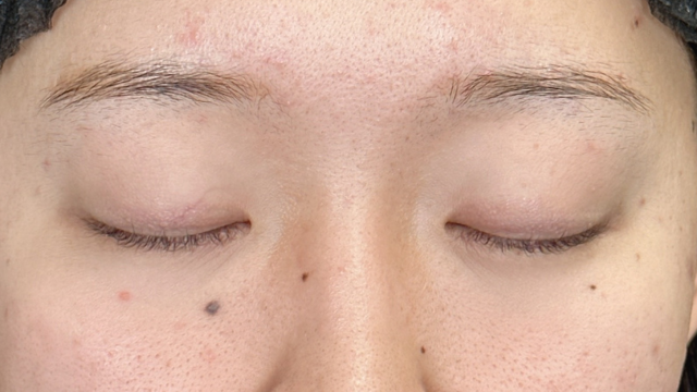 Postoperative Condition Part 1