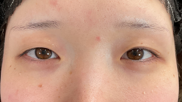 Postoperative Condition Part 1