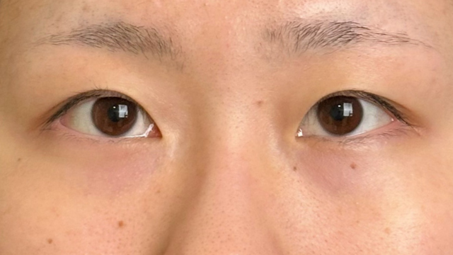 Postoperative Condition Part 1