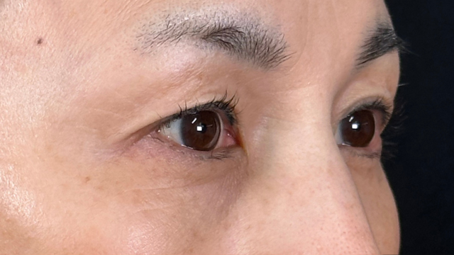 Postoperative Condition Part 1