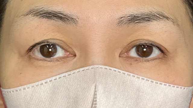 Postoperative Condition Part 1