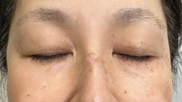 Postoperative Condition Part 1