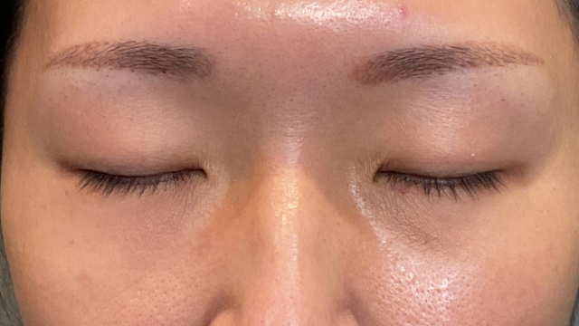 Postoperative Condition Part 1