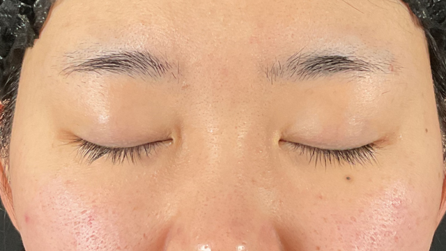 Postoperative Condition Part 1