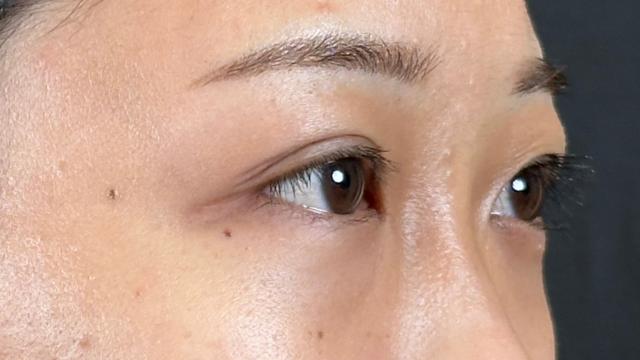 Postoperative Condition Part 1