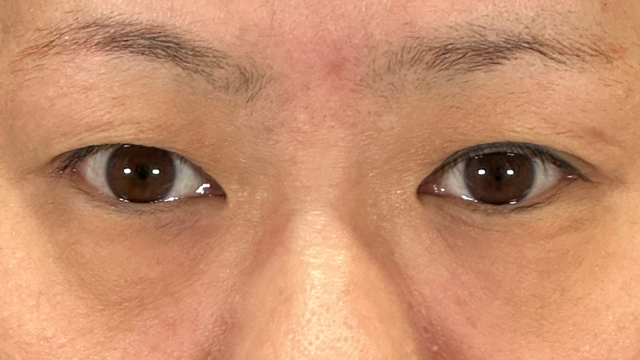 Postoperative Condition Part 1