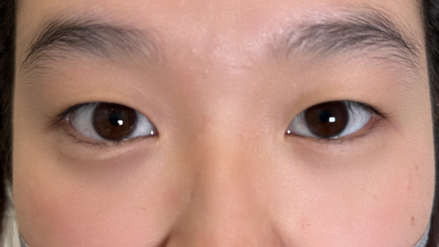 Postoperative Condition Part 1