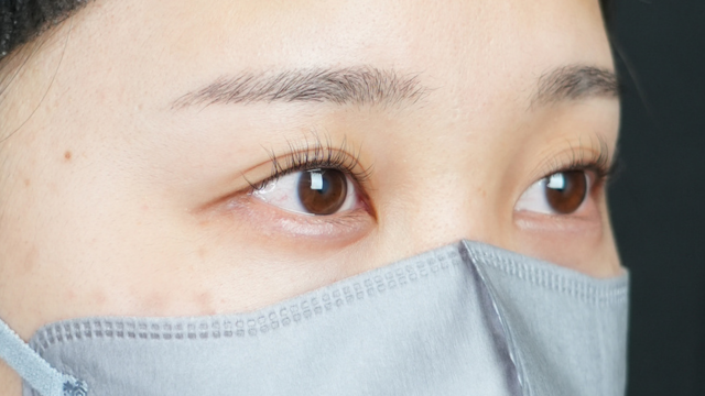 Postoperative Condition Part 1