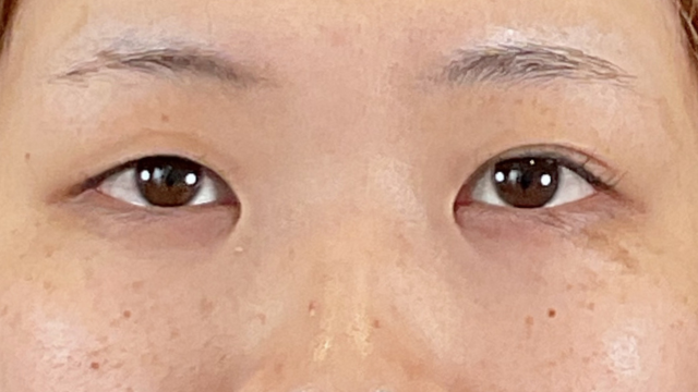 Postoperative Condition Part 1