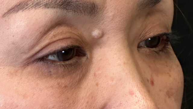 Postoperative Condition Part 1