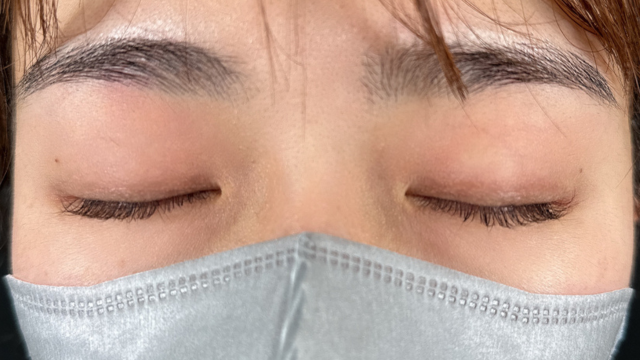 Postoperative Condition Part 1