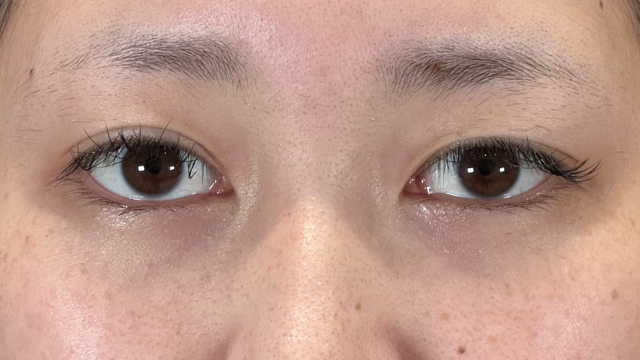 Postoperative Condition Part 1