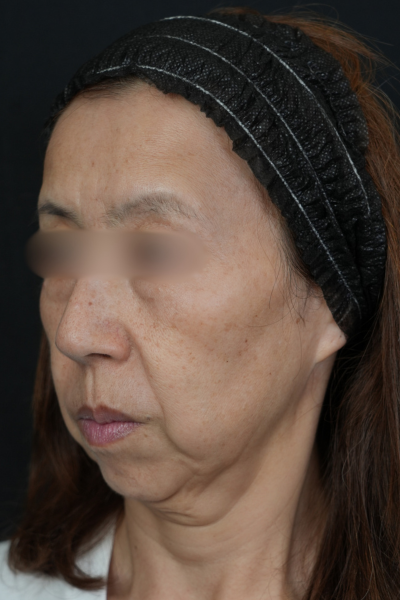 Postoperative Condition Part 1