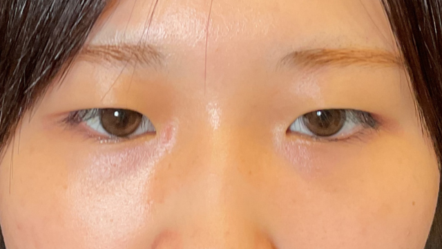 Postoperative Condition Part 1