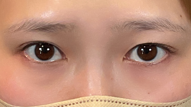 Postoperative Condition Part 1