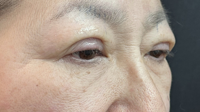 Postoperative Condition Part 1