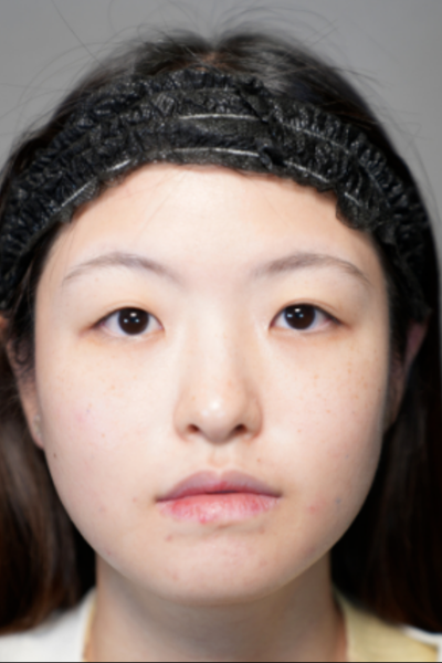 Postoperative Condition Part 1