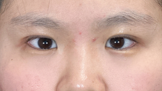 Postoperative Condition Part 1