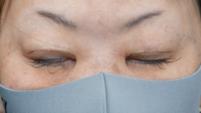 Postoperative Condition Part 1