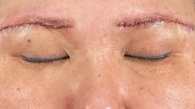 Postoperative Condition Part 1