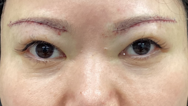 Postoperative Condition Part 1