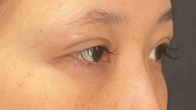 Postoperative Condition Part 1