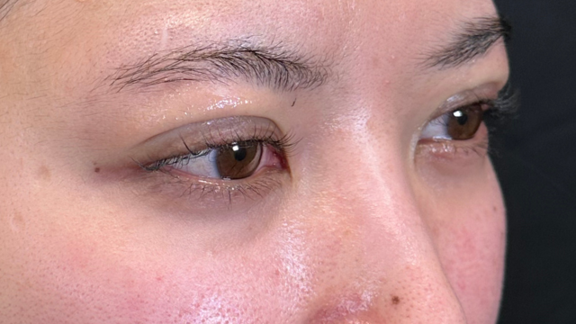 Postoperative Condition Part 1