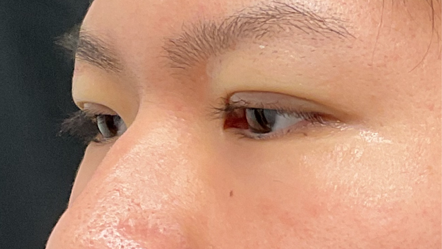 Postoperative Condition Part 1